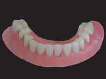 ackley-implant-dentures-procedure-6