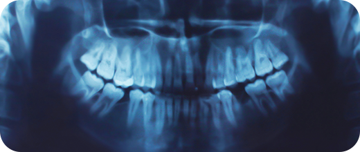 ackley-technology-xrays-v1