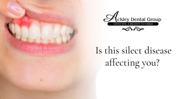 Ackley—Email—Red-Gum-Disease–1200×630—V1-